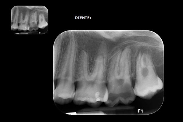 view hazards of flow reduction